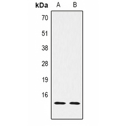 Histone H2B (DiMethyl-K5) Rabbit Polyclonal Antibody