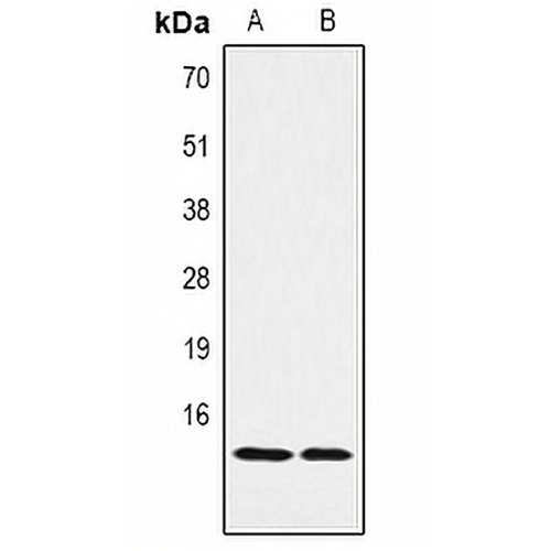 Histone H2B (MonoMethyl-K5) Rabbit Polyclonal Antibody