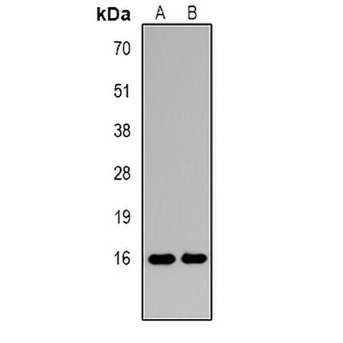 Histone H3 (DiMethyl-K27) Rabbit Polyclonal Antibody