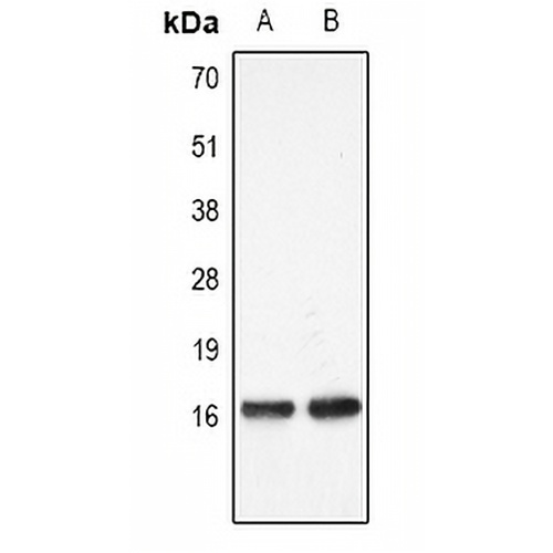 Histone H3 (MonoMethyl-K27) Rabbit Polyclonal Antibody