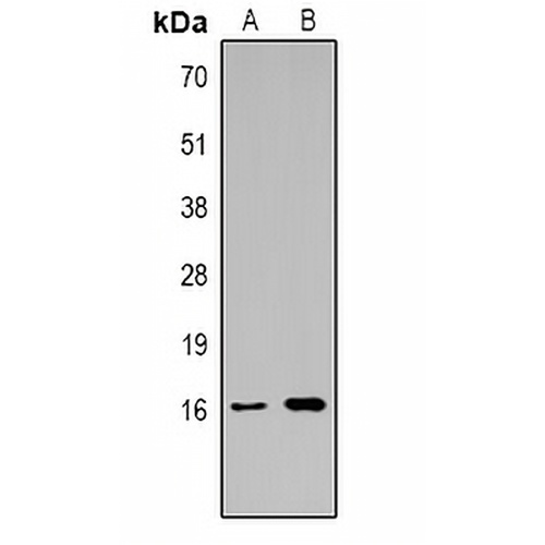 Histone H3 (TriMethyl-K14) Rabbit Polyclonal Antibody