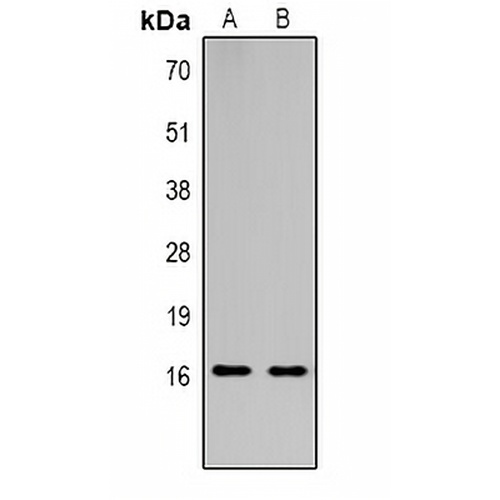 Histone H3 (TriMethyl-K18) Rabbit Polyclonal Antibody