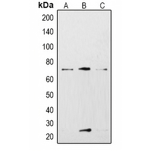 KCNN2 Rabbit Polyclonal Antibody