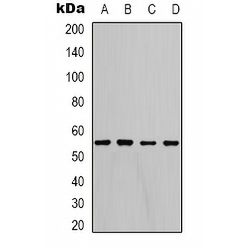 LDHD Rabbit Polyclonal Antibody