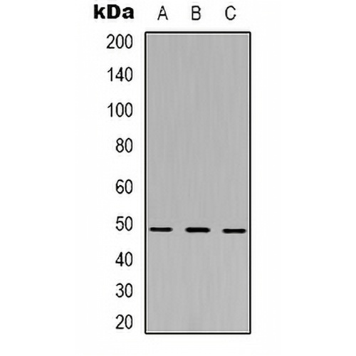 MKK5 Rabbit Polyclonal Antibody