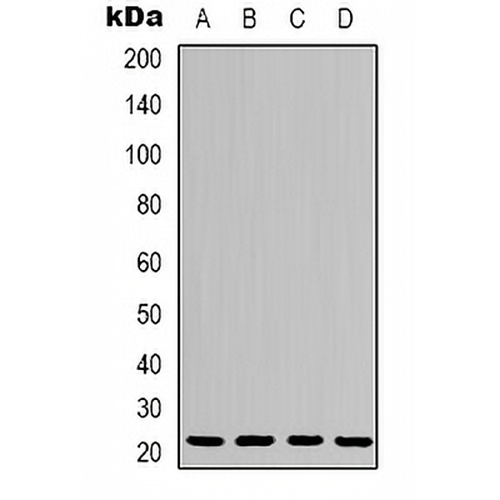p21 Rabbit Polyclonal Antibody