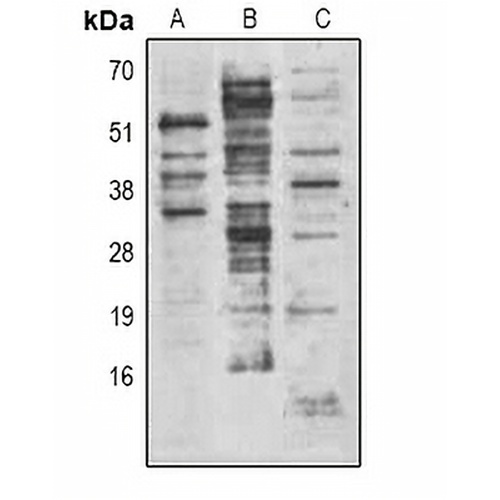 Methyl-Lysine Rabbit Polyclonal Antibody