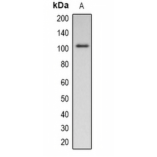 Pepsinogen C (Phospho-S15) Rabbit Polyclonal Antibody