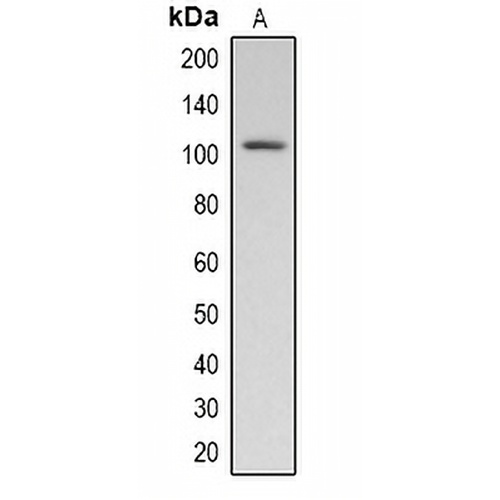 Pepsinogen C Rabbit Polyclonal Antibody