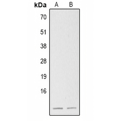 S100-B Rabbit Polyclonal Antibody