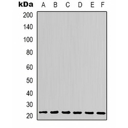 SOD2 Rabbit Polyclonal Antibody