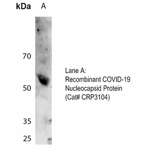COVID-19 Nucleocapsid Protein Rabbit Polyclonal Antibody