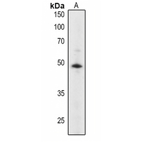 ABI2 Rabbit Polyclonal Antibody