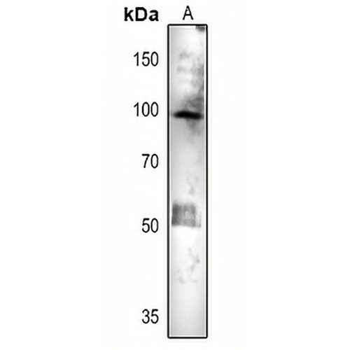 ACO1 Rabbit Polyclonal Antibody