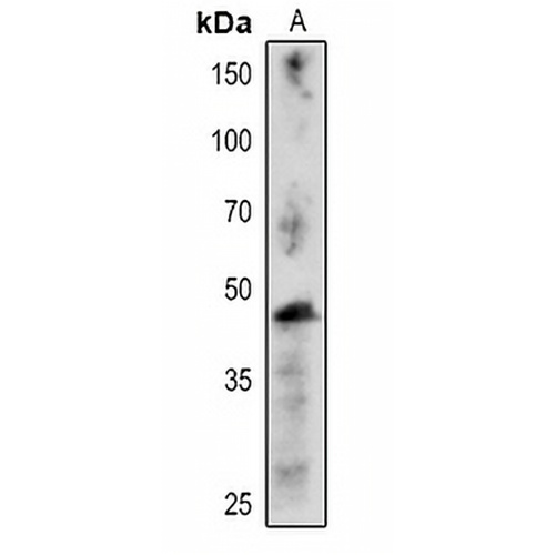 CFBP1 Rabbit Polyclonal Antibody