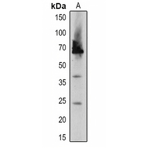 DEGP2 Rabbit Polyclonal Antibody