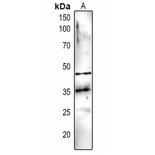 DEGP5 Rabbit Polyclonal Antibody