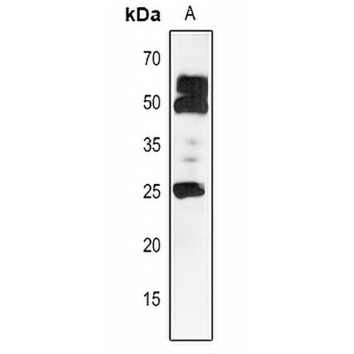 HSP25.3 Rabbit Polyclonal Antibody