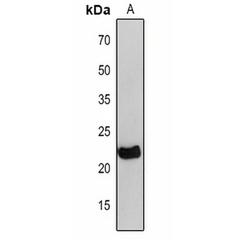 petC Rabbit Polyclonal Antibody