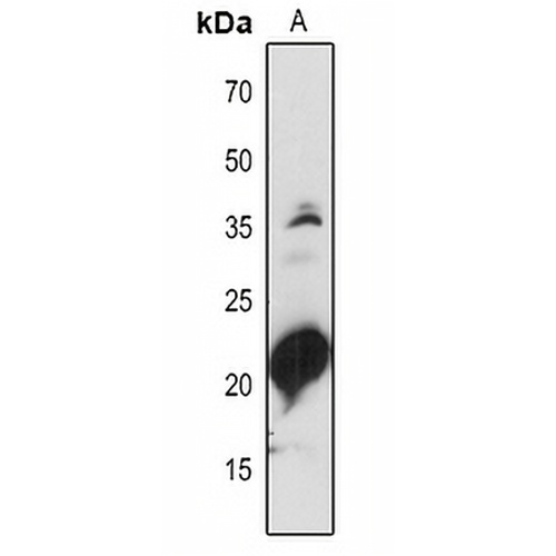 PSAD1/2 Rabbit Polyclonal Antibody