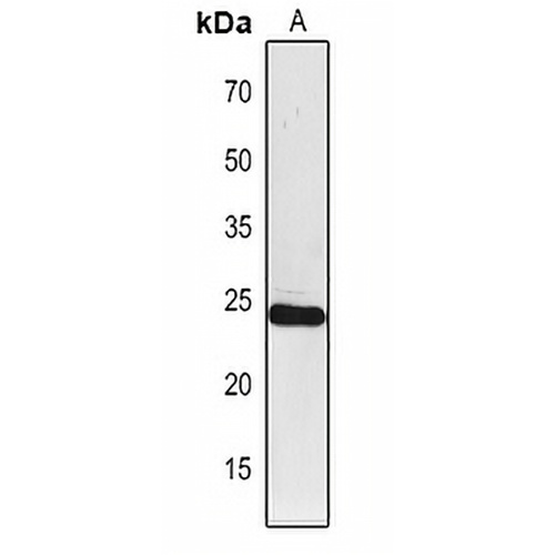 PSAF Rabbit Polyclonal Antibody