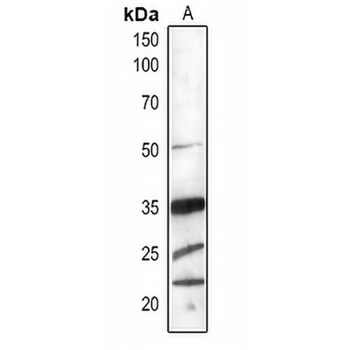 PSBO1/2 Rabbit Polyclonal Antibody