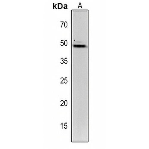 TIC40 Rabbit Polyclonal Antibody
