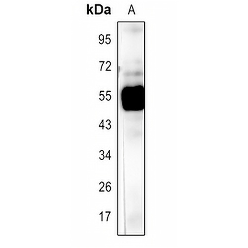 Rubisco Large Chain Rabbit Polyclonal Antibody