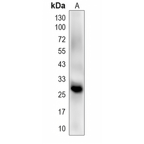 psbD Rabbit Polyclonal Antibody