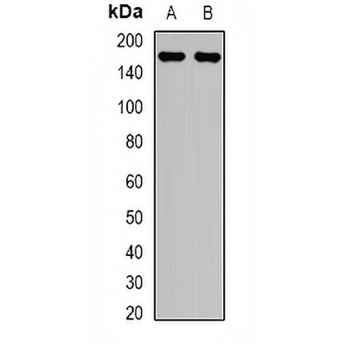 LRP5 Rabbit Polyclonal Antibody