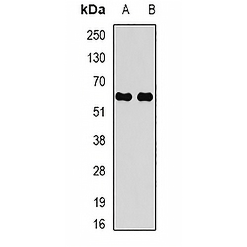 CARD 8 Rabbit Polyclonal Antibody