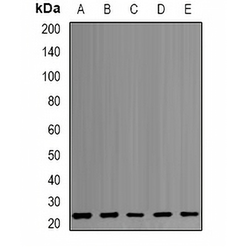 PSMB1 Rabbit Polyclonal Antibody