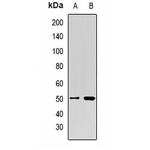 PSMD4 Rabbit Polyclonal Antibody
