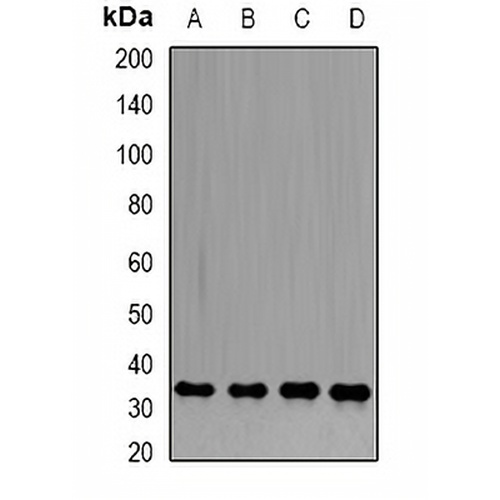 PP1 beta Rabbit Polyclonal Antibody