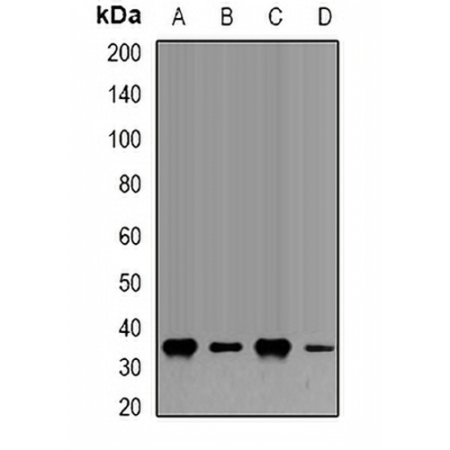 Fibrillarin Rabbit Polyclonal Antibody
