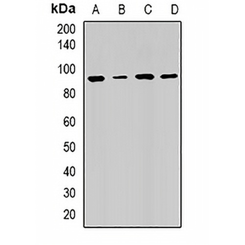 RRM1 Rabbit Polyclonal Antibody