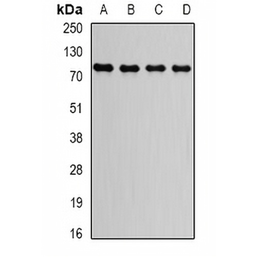 GGA2 Rabbit Polyclonal Antibody