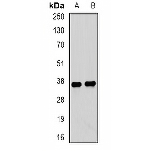 Tropomyosin 3 Rabbit Polyclonal Antibody