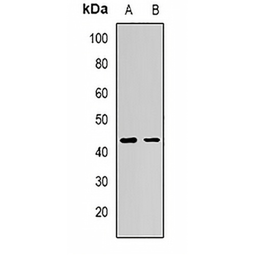 AdipoR1 Rabbit Polyclonal Antibody