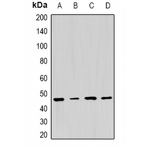 PSMC5 Rabbit Polyclonal Antibody