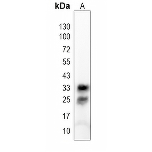 SULT1A1 Rabbit Polyclonal Antibody