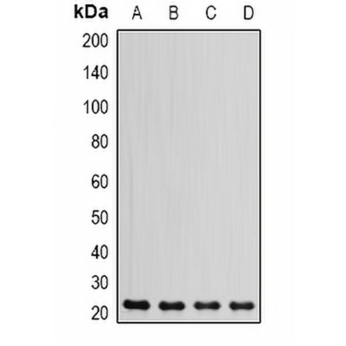 DHFR Rabbit Polyclonal Antibody