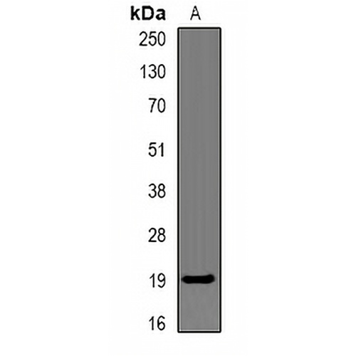CAP18 Rabbit Polyclonal Antibody