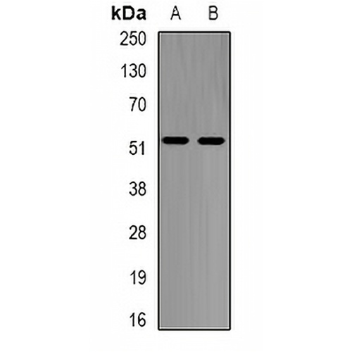Alpha-galactosidase A Rabbit Polyclonal Antibody