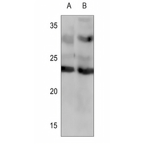 Frataxin Rabbit Polyclonal Antibody