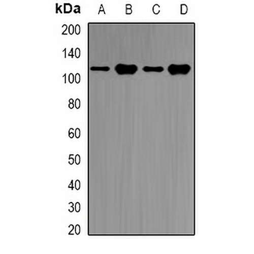 E6AP Rabbit Polyclonal Antibody
