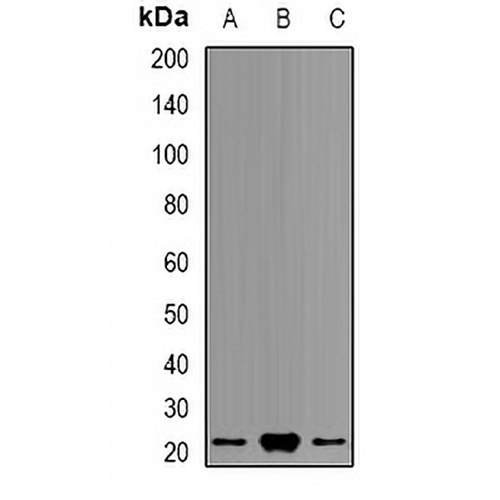 PSMB9 Rabbit Polyclonal Antibody