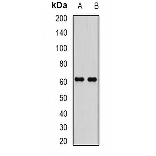 EPHX2 Rabbit Polyclonal Antibody