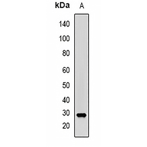 PGD2 synthase Rabbit Polyclonal Antibody