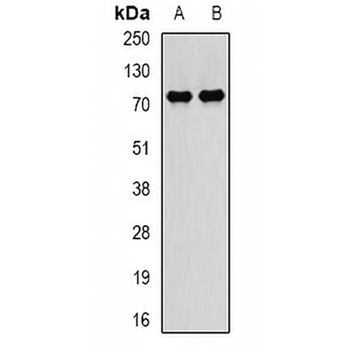PADI4 Rabbit Polyclonal Antibody